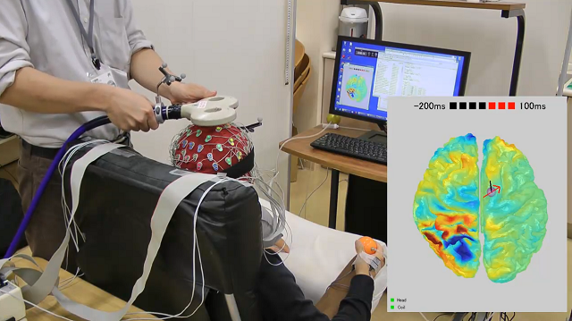脳活動を確認しながらTMSを行える装置